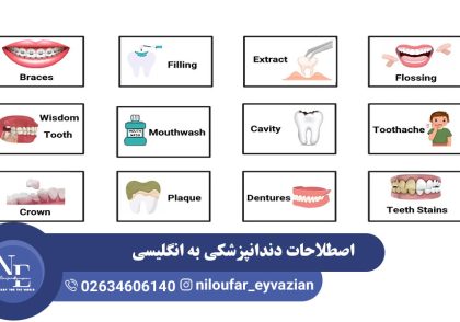 اصطلاحات دندانپزشکی به انگلیسی
